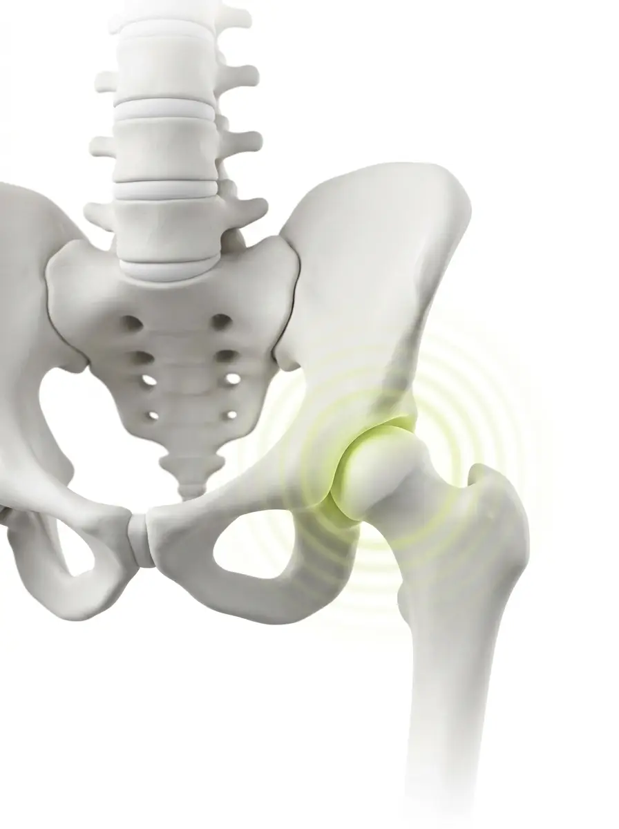 3D pelvis and hip joint anatomy with soft chartreuse hip highlight
